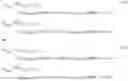 Fig. 29 - Compensated deep propagation measurements with differential rotation