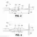 Fig. 04 - Adjustable focal plane optical system