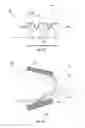 Fig. 17 - Lithographic method