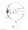 Fig. 02 - Detecting eye movement based on a wearable detection apparatus
