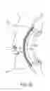 Fig. 14 - Detecting eye movement based on a wearable detection apparatus