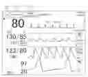 Fig. 01 - Biological information displaying apparatus