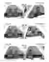 Fig. 09 - Content aware fill based on similar images
