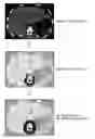 Fig. 01 - Medical image processing apparatus and medical image processing method