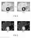 Fig. 05 - Medical image processing apparatus and medical image processing method