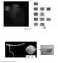 Fig. 17 - Synthetic data-driven hemodynamic determination in medical imaging