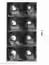 Fig. 07 - Systems and methods for three-dimensional spiral perfusion imaging