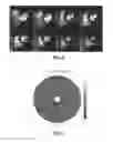 Fig. 09 - Systems and methods for three-dimensional spiral perfusion imaging
