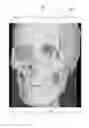 Fig. 01 - Apparatus and method for reconstructing medical image