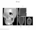 Fig. 03 - Apparatus and method for reconstructing medical image