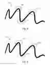 Fig. 04 - Redrawing recent curve sections for real-time smoothing