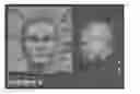Fig. 01 - Gesture-based editing of 3D models for hair transplantation applications
