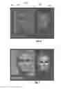 Fig. 04 - Gesture-based editing of 3D models for hair transplantation applications