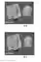 Fig. 06 - Gesture-based editing of 3D models for hair transplantation applications