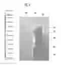 Fig. 09 - Micro X-ray tube