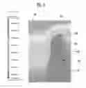 Fig. 10 - Micro X-ray tube