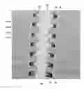Fig. 01 - Metal word lines for three dimensional memory devices
