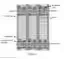 Fig. 02 - Array substrate and method of manufacturing the same, and liquid crystal display screen