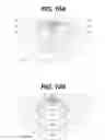 Fig. 22 - Light emitting device substrate with inclined sidewalls