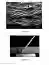 Fig. 07 - Microporous membrane separators for lithium ion rechargeable batteries and related methods