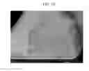 Fig. 03 - Positive active material for rechargeable lithium battery, method of preparing same, and rechargeable lithium battery including same