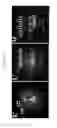 Fig. 12 - Positive active material for rechargeable lithium battery, method of preparing same, and rechargeable lithium battery including same