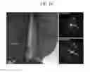 Fig. 20 - Positive active material for rechargeable lithium battery, method of preparing same, and rechargeable lithium battery including same