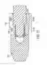 Fig. 15 - Center conductor tip