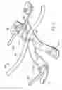 Fig. 06 - Cable mounting bracket apparatus and system