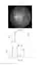 Fig. 14 - Imaging to facilitate object gaze