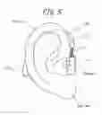 Fig. 06 - Measurement device and measurement system
