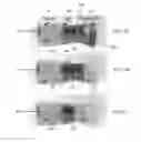 Fig. 12 - Adjustable venting for hearing instruments