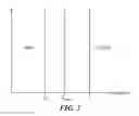 Fig. 04 - Apparatus and method for detecting earphone removal and insertion