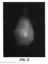 Fig. 03 - Pear Tree Named 'CH201'