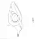 Fig. 06 - HIGH HEEL SHOES WITH INTEGRATED CUSHIONING