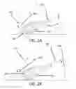Fig. 06 - Dual-mode cane, a kit for converting a white cane to a dual-mode cane, and a method for converting a white cane to a dual-mode cane