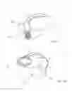 Fig. 20 - Vacuum assisted systems and methods for grooming hair