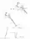 Fig. 03 - WRIST MOUNTED HAND SLING
