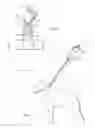Fig. 04 - WRIST MOUNTED HAND SLING