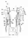 Fig. 01 - Infant carrier with adjustable side panels and torso band