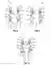 Fig. 05 - Infant carrier with adjustable side panels and torso band