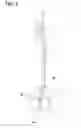 Fig. 03 - JEWELRY HOLDER