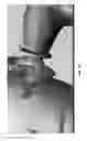 Fig. 04 - Air removal and fluid transfer from a closed system