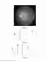 Fig. 08 - Imaging to facilitate object observation