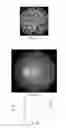 Fig. 13 - Imaging for local scaling