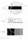 Fig. 25 - Method and system for eye measurements and cataract surgery planning using vector function derived from prior surgeries