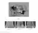 Fig. 02 - HIGH-RESOLUTION THERMAL IMAGING SYSTEM, APPARATUS, METHOD AND COMPUTER ACCESSIBLE MEDIUM