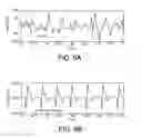 Fig. 10 - Defibrillator Display