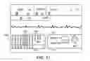Fig. 19 - Defibrillator Display
