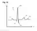 Fig. 09 - Method for efficiently encoding and compressing ECG data optimized for use in an ambulatory ECG monitor